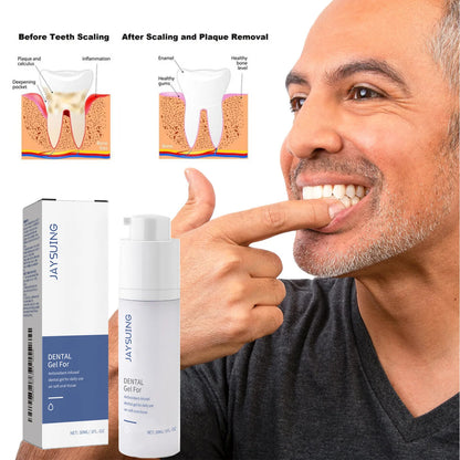 Teeth Cleaning Gel: Plaque & Stain Remover, Fresh Breath